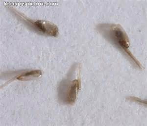 Lice eggs or nits 